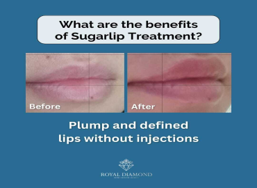 SUGAR LIPS